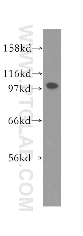 Jurkat cell were subjected to SDS PAGE followed by western blot with 12636-1-AP(FAK Antibody) at dilution of 1:2000 FAK western blot WB 12636-1-AP FAK Antibody PTK2;FADK;FAK;FAK1;pp125FAK ;