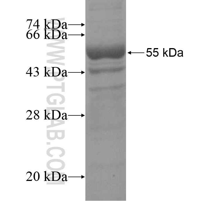 FAM101A fusion protein ag15231 SDS-PAGE