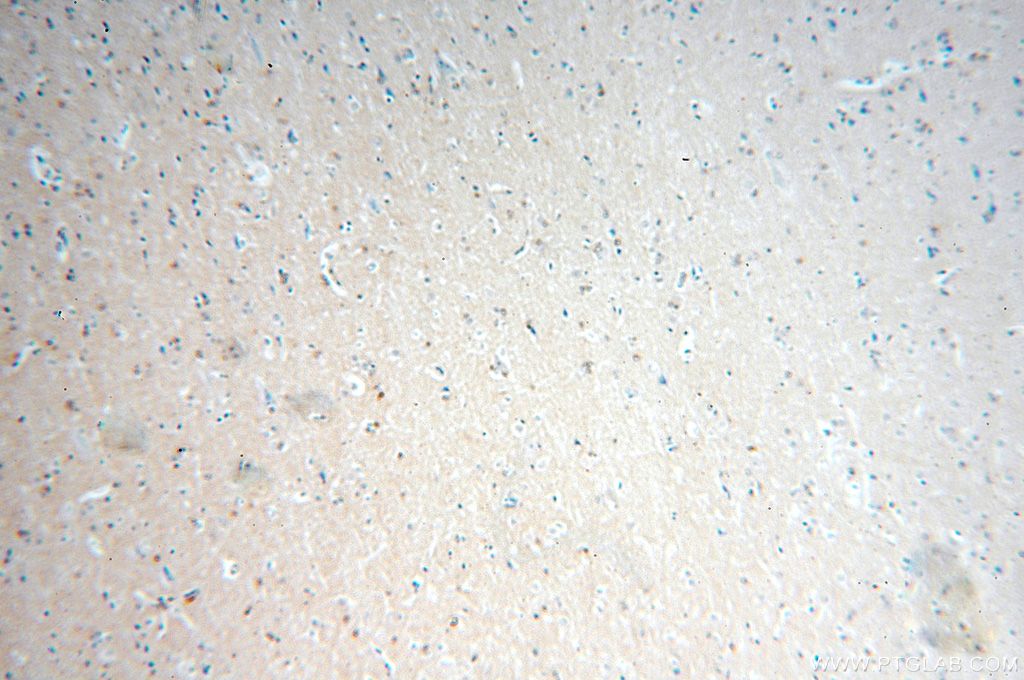 FAM118B IHC Immunohistochemical 18159-1-AP FAM118B Antibody FLJ21103