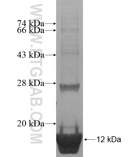 FAM78A fusion protein ag15643 SDS-PAGE