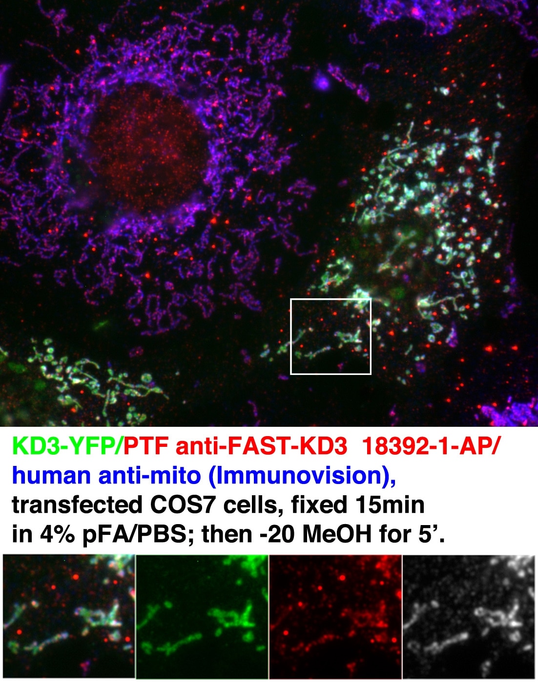 IF result of anti-FASTKD3 (18392-1-AP, 1:200) with transfected COS7 cell by Dr. Nancy Kedersha. FASTKD3 IF 18392-1-AP FASTKD3 Antibody FLJ23274; MGC142123; MGC5297