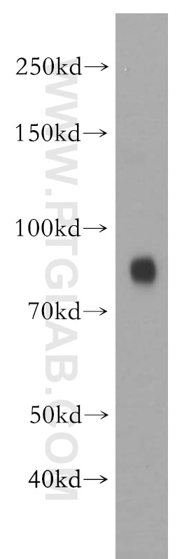 human brain tissue were subjected to SDS PAGE followed by western blot with 20425-1-AP(FBLN1 Antibody) at dilution of 1:1500 FBLN1 western blot WB 20425-1-AP FBLN1 Antibody FBLN