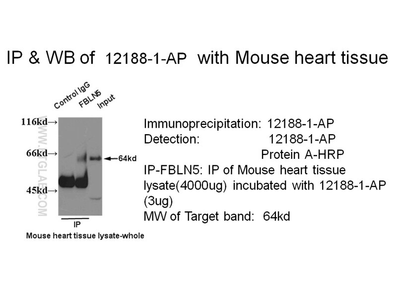 FBLN5 IP 12188-1-AP FBLN5 Antibody ARMD3; DANCE; EVEC; FIBL-5; FLJ90059; UP50