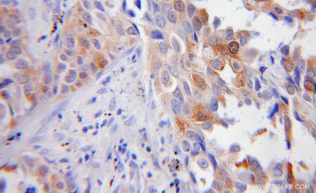 FBLN5 IHC Immunohistochemical 12188-1-AP FBLN5 Antibody ARMD3; DANCE; EVEC; FIBL-5; FLJ90059; UP50