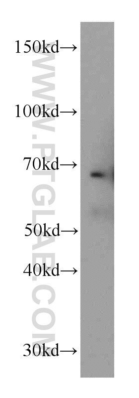FBLN5 western blot WB 12188-1-AP FBLN5 Antibody ARMD3; DANCE; EVEC; FIBL-5; FLJ90059; UP50