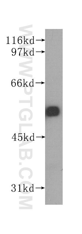 FBLN5 western blot WB 60081-1-Ig FBLN5 Antibody ARMD3; DANCE; EVEC; FIBL-5; FLJ90059; UP50