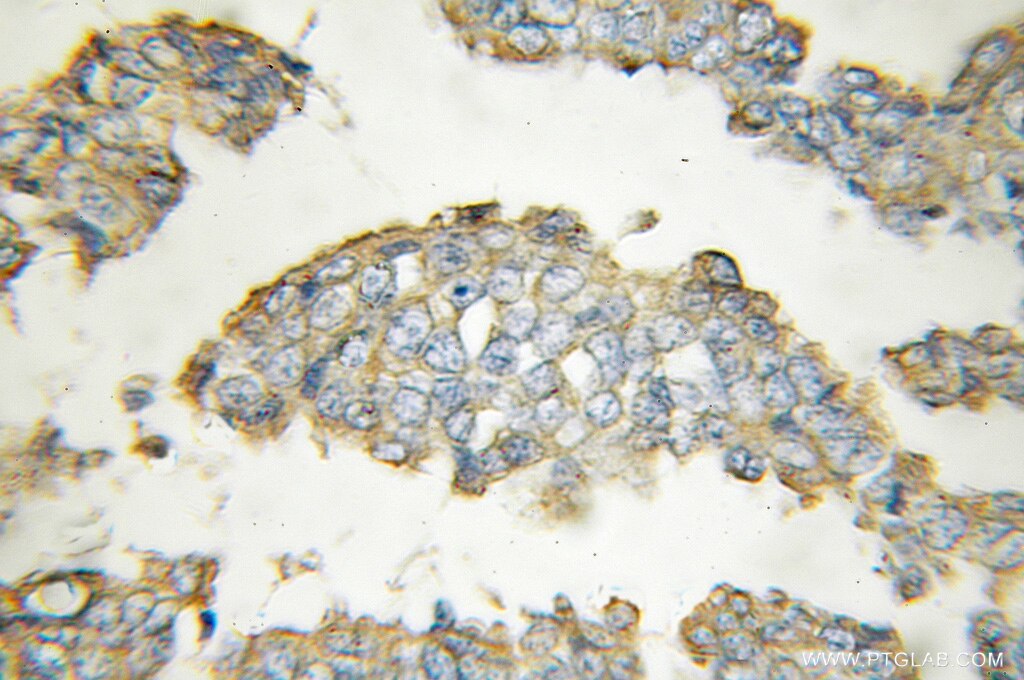 FBRS IHC Immunohistochemical 11356-1-AP FBRS Antibody FBS; FBS1; FLJ11618