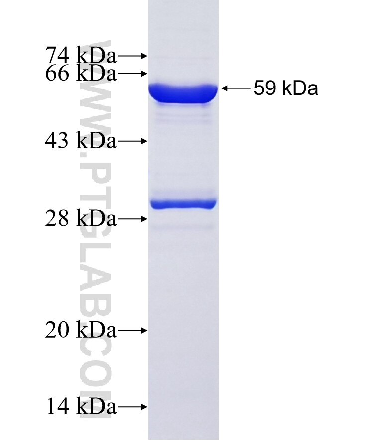 FBXL15 fusion protein ag14949 SDS-PAGE