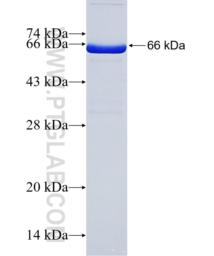 FBXO2 fusion protein ag6122 SDS-PAGE
