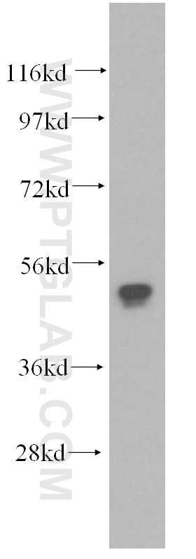 FCGR2A western blot WB 15625-1-AP FCGR2A Antibody CD32; CD32A; CDw32; FCG2; FCGR2; FCGR2A1; FcGR; IGFR2; MGC23887; MGC30032