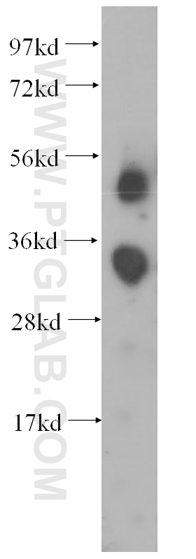 human placenta tissue were subjected to SDS PAGE followed by western blot with 11867-1-AP(FCN3 Antibody) at dilution of 1:1000 FCN3 western blot WB 11867-1-AP FCN3 Antibody FCNH; HAKA1; MGC22543
