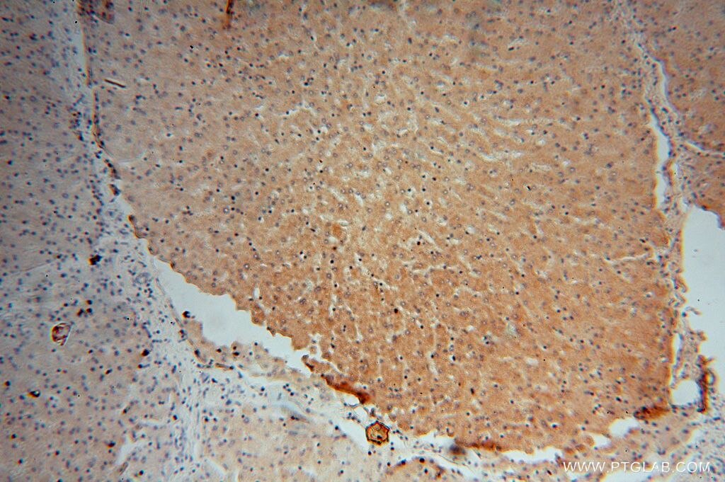FDXR IHC Immunohistochemical 15584-1-AP FDXR Antibody ADXR
