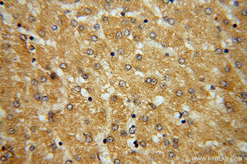FDXR IHC Immunohistochemical 15584-1-AP FDXR Antibody ADXR