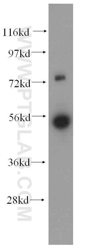FDXR western blot WB 15584-1-AP FDXR Antibody ADXR