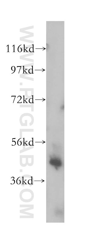 human heart tissue were subjected to SDS PAGE followed by western blot with 14466-1-AP(FECH Antibody) at dilution of 1:1000 FECH western blot WB 14466-1-AP FECH Antibody EPP; FCE