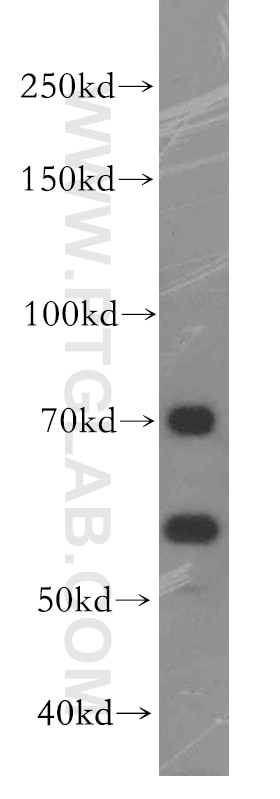 PC-3 cells were subjected to SDS PAGE followed by western blot with 19544-1-AP(FEM1B Antibody) at dilution of 1:500 FEM1B western blot WB 19544-1-AP FEM1B Antibody DKFZp451E0710; FIAA