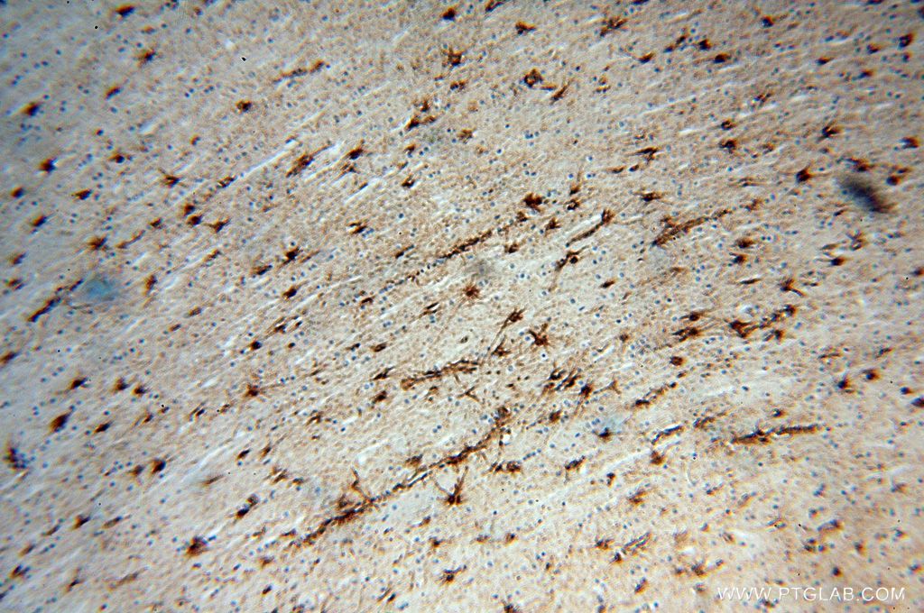 FGF1 IHC Immunohistochemical 17400-1-AP FGF1 Antibody AFGF; ECGF; ECGF-beta; ECGFA; ECGFB; FGF-alpha; FGFA; GLIO703; HBGF1