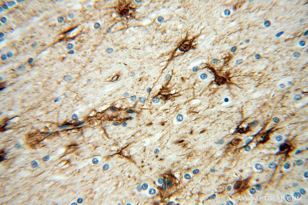 FGF1 IHC Immunohistochemical 17400-1-AP FGF1 Antibody AFGF; ECGF; ECGF-beta; ECGFA; ECGFB; FGF-alpha; FGFA; GLIO703; HBGF1
