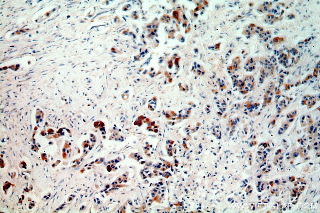 FGF8 IHC Immunohistochemical 20711-1-AP FGF8 Antibody AIGF; HBGF-8; KAL6; MGC149376