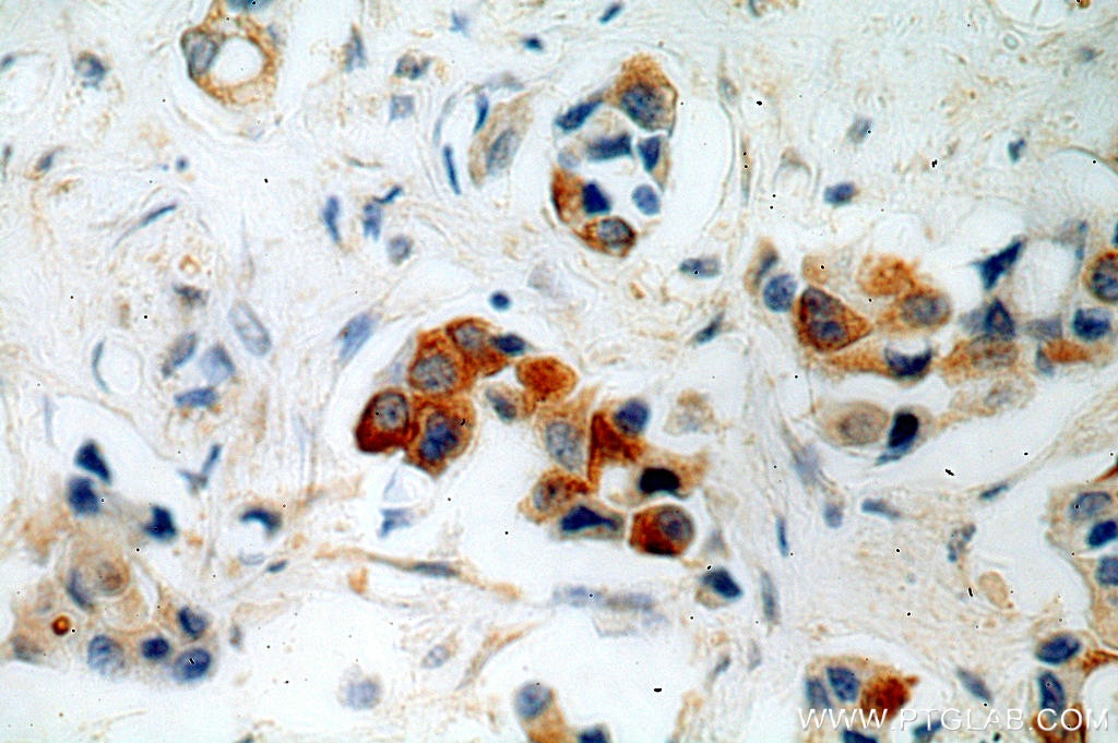FGF8 IHC Immunohistochemical 20711-1-AP FGF8 Antibody AIGF; HBGF-8; KAL6; MGC149376