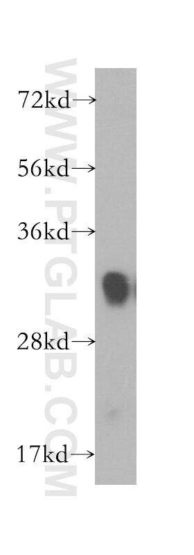 human brain tissue were subjected to SDS PAGE followed by western blot with 10991-1-AP(FHL1 Antibody) at dilution of 1:1200 FHL1 western blot WB 10991-1-AP FHL1 Antibody FHL1B; FLH1A; KYO-T; MGC111107; SLIM1; XMPMA; bA535K18.1