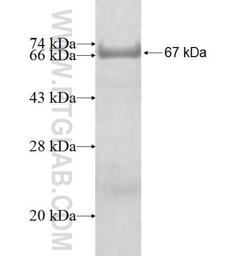 FIBP fusion protein ag8743 SDS-PAGE
