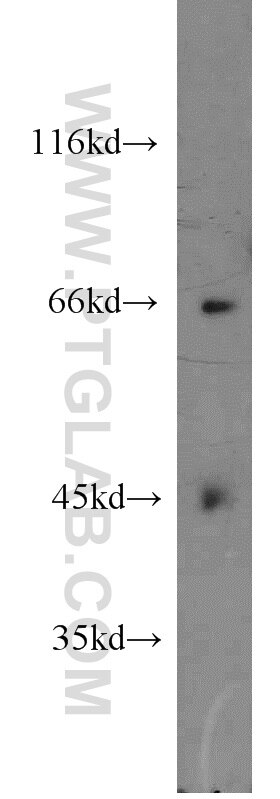 HeLa cells were subjected to SDS PAGE followed by western blot with 17604-1-AP(FIGNL1 Antibody) at dilution of 1:800 FIGNL1 western blot WB 17604-1-AP FIGNL1 Antibody