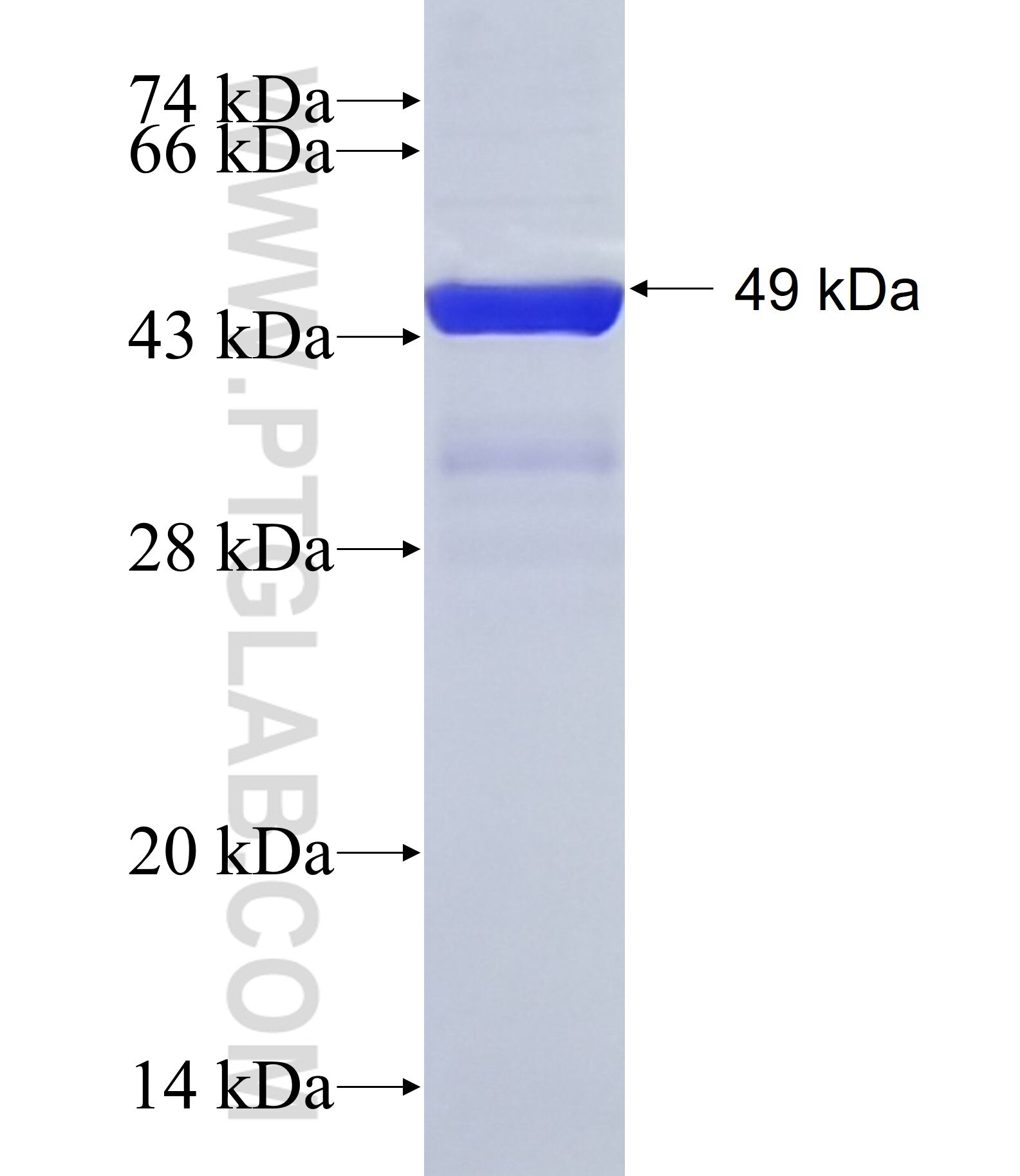 FKBP11 fusion protein ag11368 SDS-PAGE