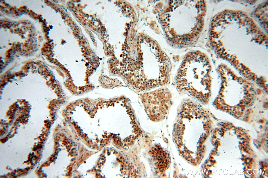 FKBPL IHC Immunohistochemical 10060-1-AP FKBPL Antibody FKBPL;DIR1;NG7;WISP39 ;