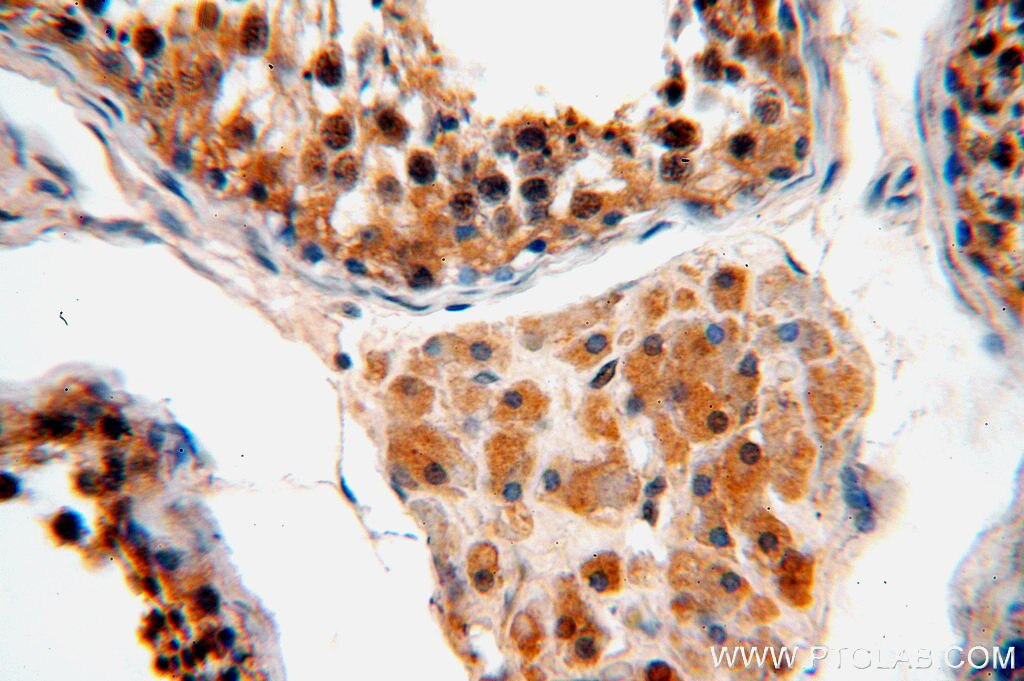 FKBPL IHC Immunohistochemical 10060-1-AP FKBPL Antibody FKBPL;DIR1;NG7;WISP39 ;