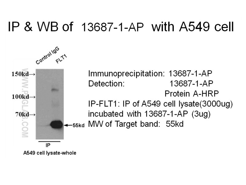 VEGFR1, FLT1 IP 13687-1-AP VEGFR1, FLT1 Antibody FLT; VEGFR1