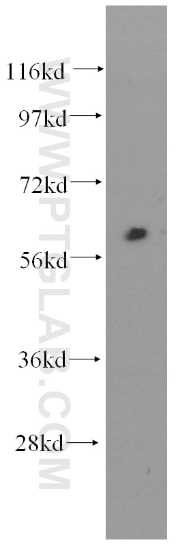 Human kidney were subjected to SDS PAGE followed by western blot with 60108-1-Ig(FMOD Antibody) at dilution of 1:500 FMOD western blot WB 60108-1-Ig FMOD Antibody SLRR2E