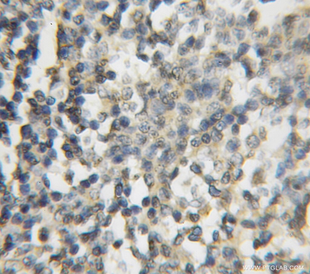 FNTB IHC Immunohistochemical 11507-1-AP FNTB Antibody FPTB; MGC31935