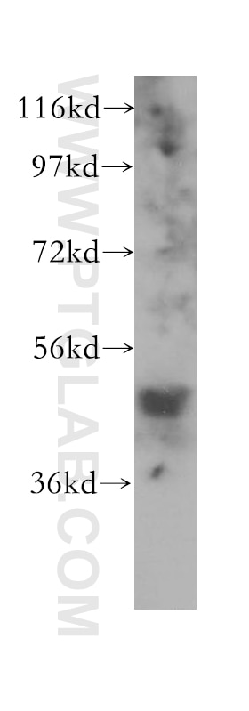 FNTB western blot WB 11507-1-AP FNTB Antibody FPTB; MGC31935