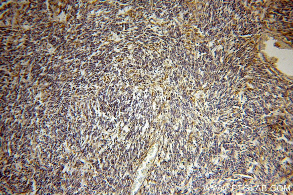 FSTL1 IHC Immunohistochemical 20182-1-AP FSTL1 Antibody FLJ50214; FLJ52277; FRP; FSL1