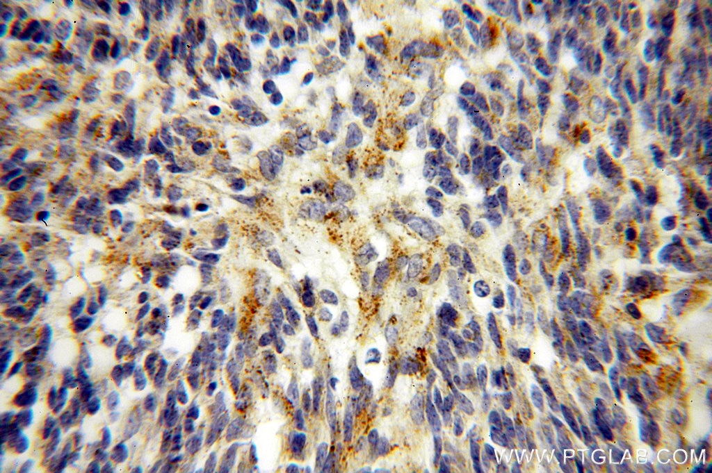 FSTL1 IHC Immunohistochemical 20182-1-AP FSTL1 Antibody FLJ50214; FLJ52277; FRP; FSL1