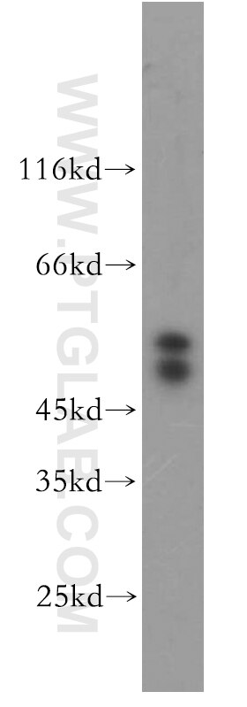 FSTL1 western blot WB 20182-1-AP FSTL1 Antibody FLJ50214; FLJ52277; FRP; FSL1