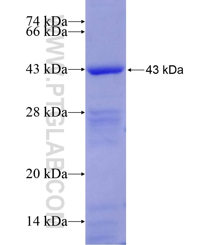 FTCD fusion protein ag17429 SDS-PAGE