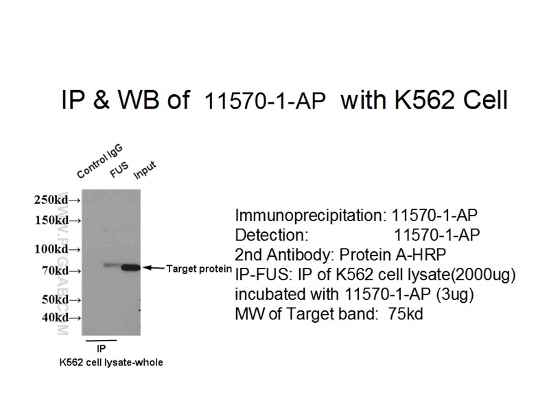 FUS IP 11570-1-AP FUS Antibody CHOP; FUS-CHOP; FUS1; TLS; TLS/CHOP; hnRNP-P2