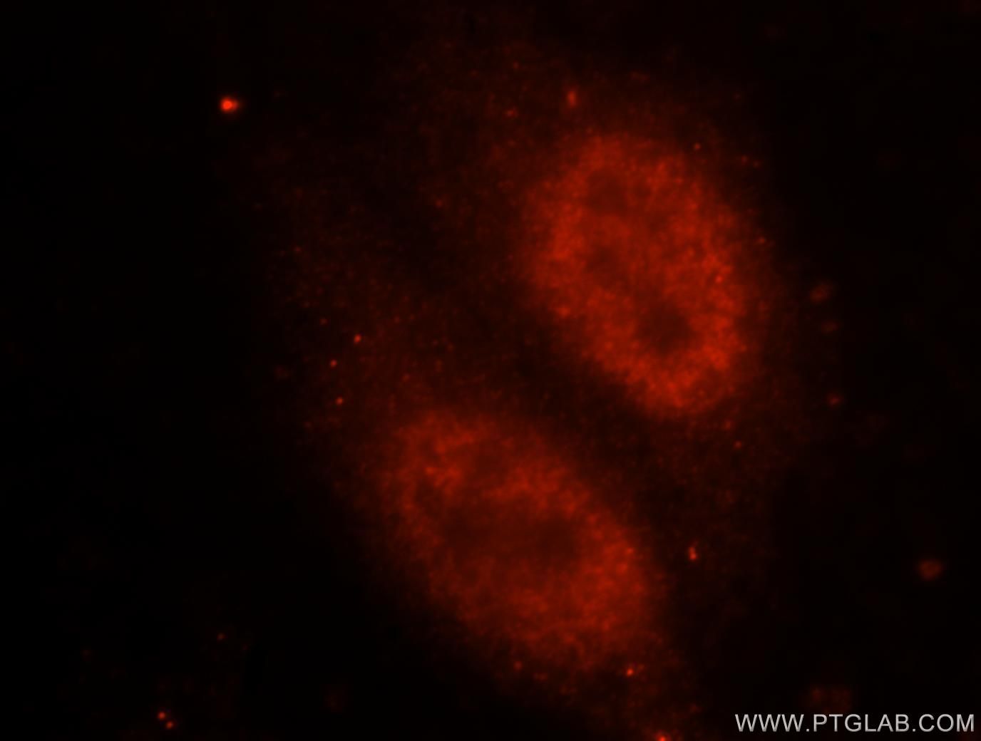 FUS Immunofluorescence IF 11570-1-AP FUS Antibody CHOP; FUS-CHOP; FUS1; TLS; TLS/CHOP; hnRNP-P2