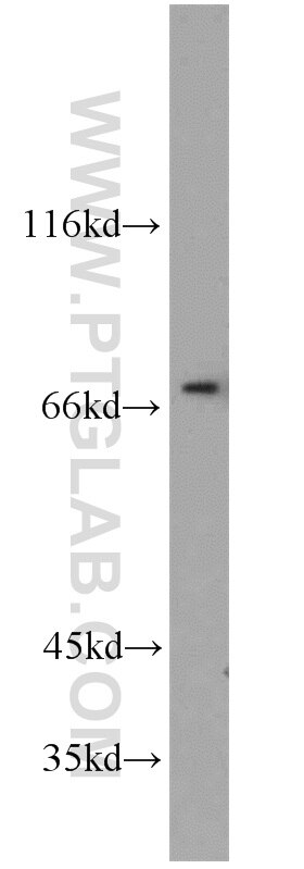 FUS western blot WB 11570-1-AP FUS Antibody CHOP; FUS-CHOP; FUS1; TLS; TLS/CHOP; hnRNP-P2