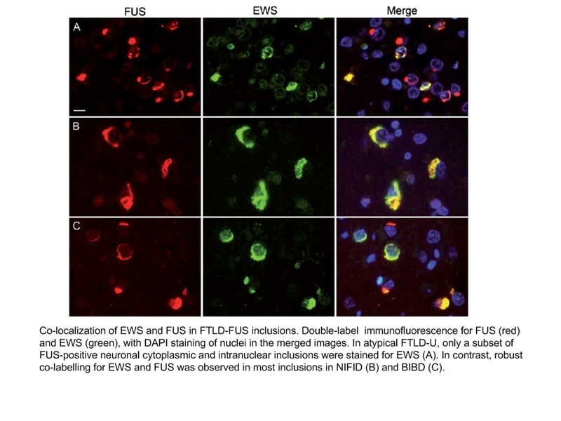 FUS IF 60160-1-Ig FUS Antibody CHOP; FUS-CHOP; FUS1; TLS; TLS/CHOP; hnRNP-P2