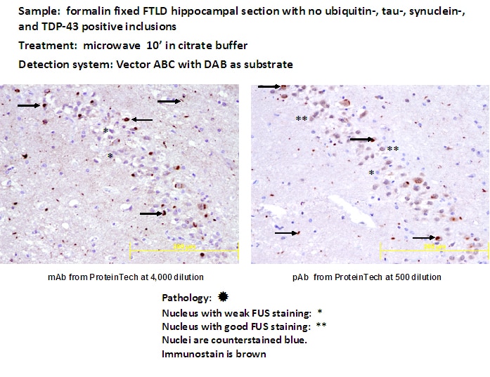 FUS IHC 60160-1-Ig FUS Antibody CHOP; FUS-CHOP; FUS1; TLS; TLS/CHOP; hnRNP-P2