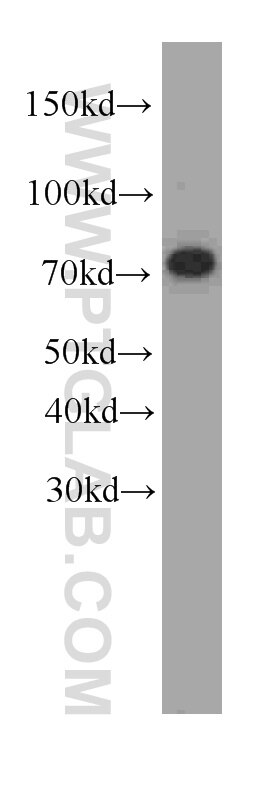 FUS western blot WB 60160-1-Ig FUS Antibody CHOP; FUS-CHOP; FUS1; TLS; TLS/CHOP; hnRNP-P2