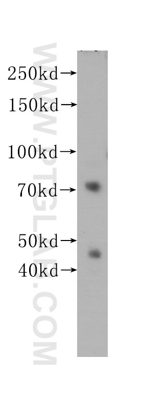 FUS western blot WB 60160-1-Ig FUS Antibody FUS;CHOP;FUS-CHOP;FUS1;TLS;TLS/CHOP;hnRNP-P2 ;
