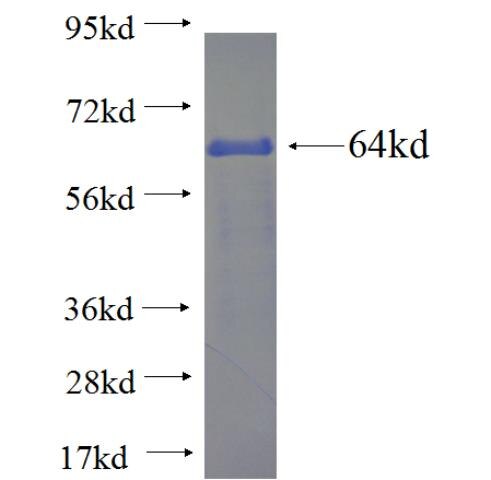 FUS fusion protein ag2150 SDS-PAGE