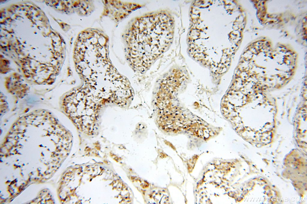 FUT11 IHC Immunohistochemical 17175-1-AP FUT11 Antibody MGC119338; MGC119339; MGC33202