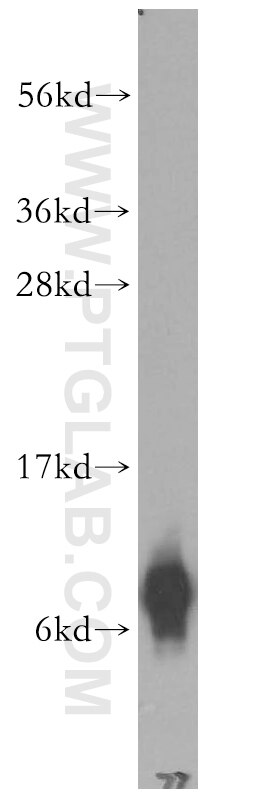COLO 320 cells were subjected to SDS PAGE followed by western blot with 15853-1-AP(FXYD3 Antibody) at dilution of 1:1000 FXYD3 western blot WB 15853-1-AP FXYD3 Antibody MAT-8; MAT8; MGC111076; PLML
