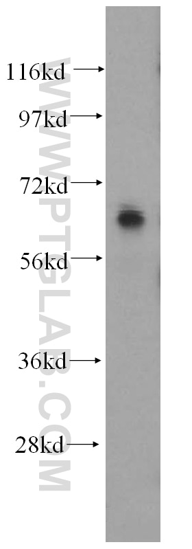 FZD9 western blot WB 13865-1-AP FZD9 Antibody CD349; FZD3