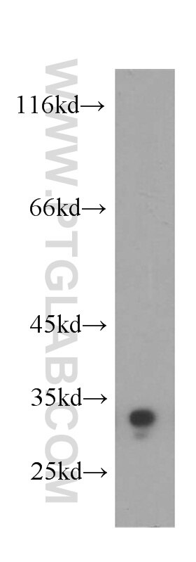 Flag-Tag western blot WB 60002-1-Ig Flag-Tag Antibody